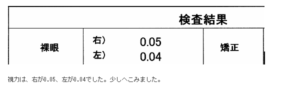 視力は、右が0.05、左が0.04でした。少しへこみました。